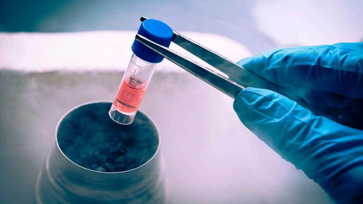 Criopreservación y almacenamiento