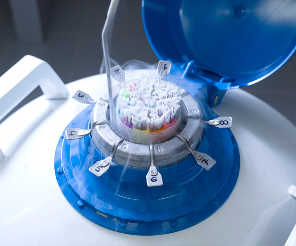 Vitrificación de los óvulos