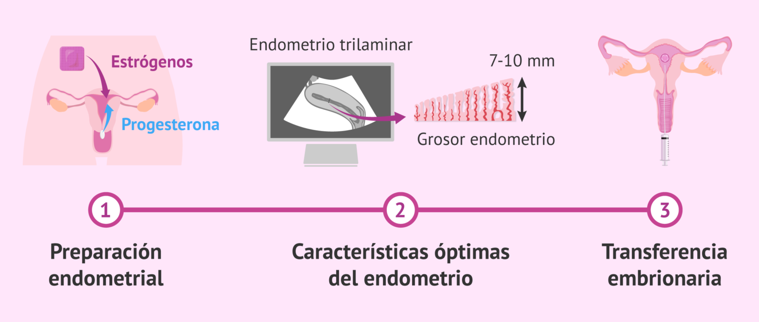 Preparación endometrial